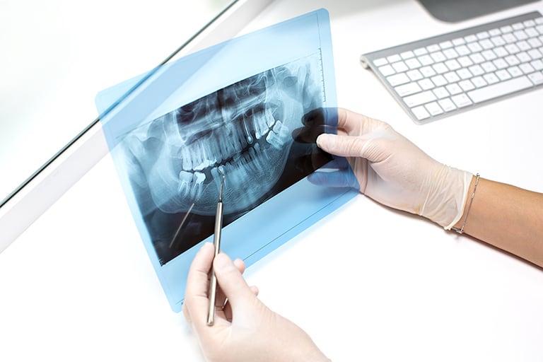 reparacion material dental mallorca | Mastecnic